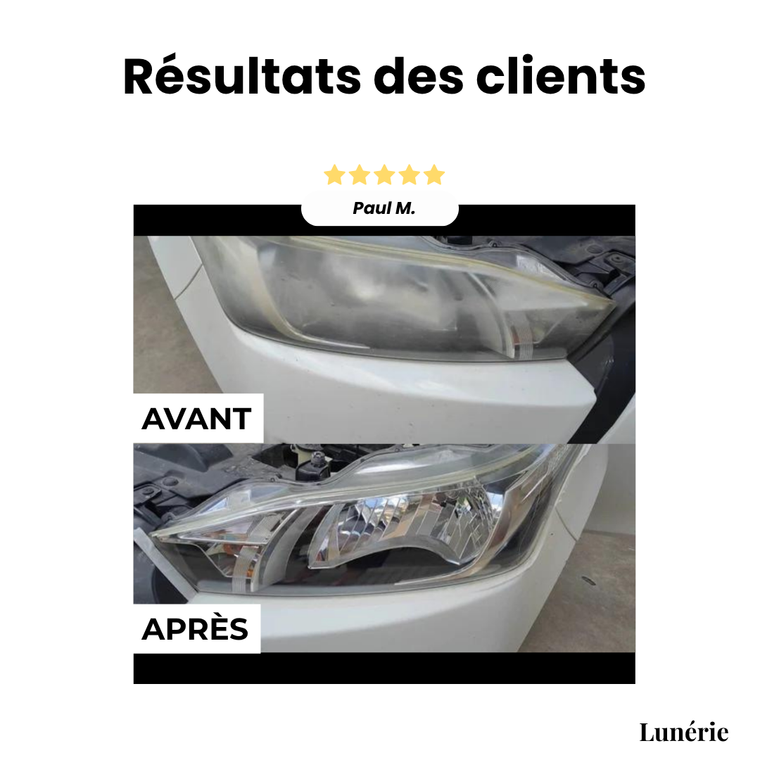 Dernier Jour -50% | ClearView™ Liquide de réparation pour phares