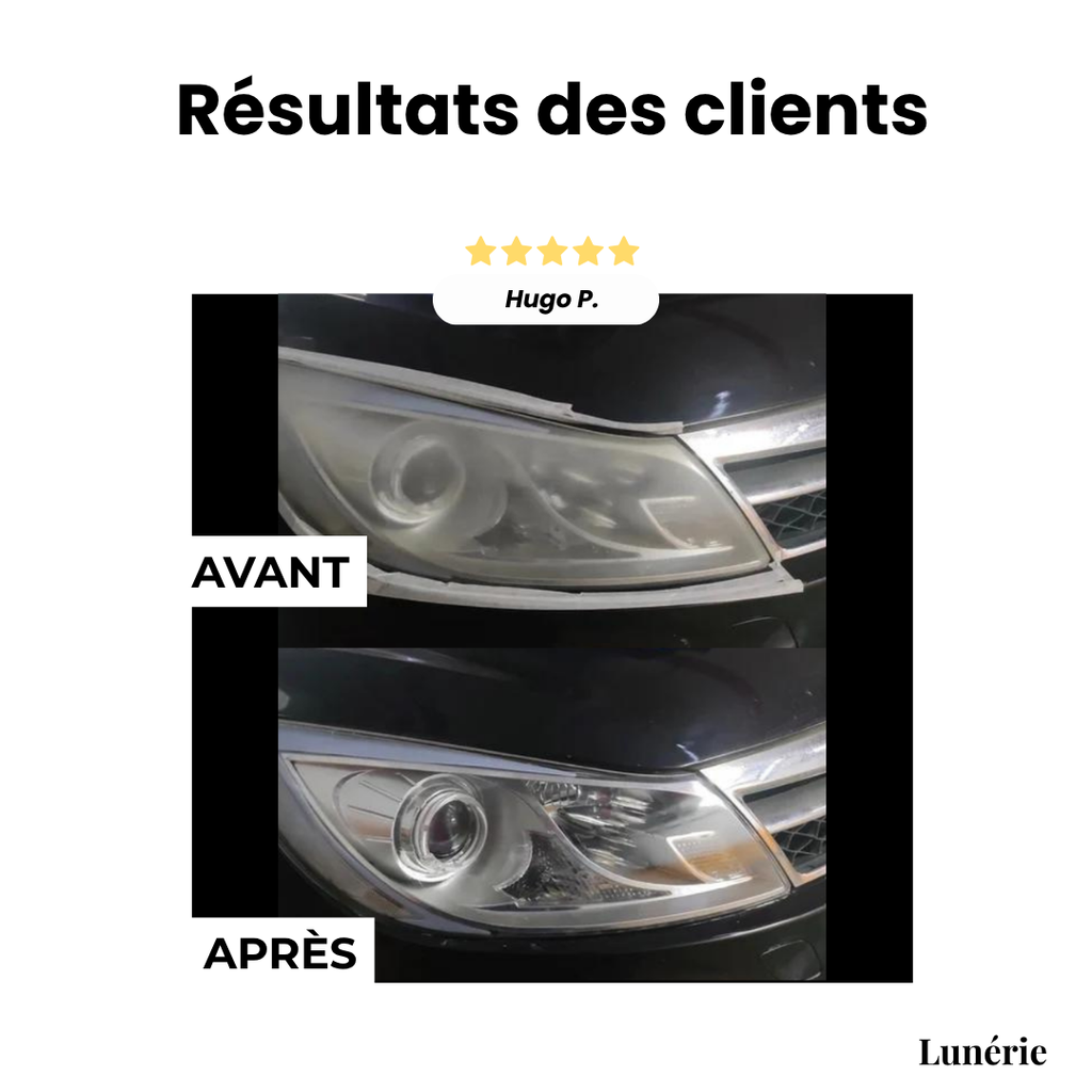 Dernier Jour -50% | ClearView™ Liquide de réparation pour phares