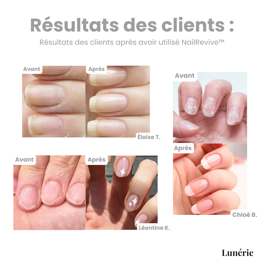 1 ACHETÉ = 1 OFFERT | NailRevive™ - Huile de Croissance pour Ongles