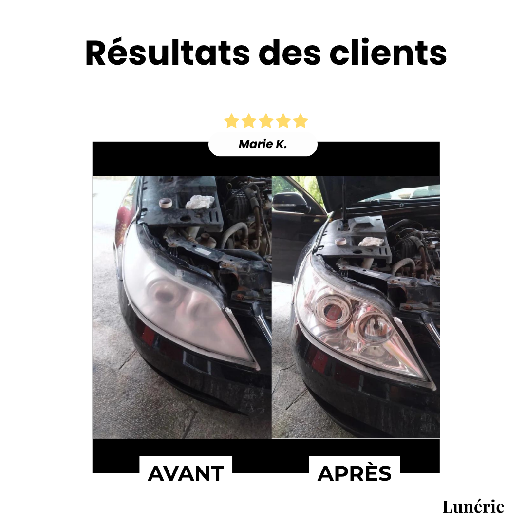 Dernier Jour -50% | ClearView™ Liquide de réparation pour phares