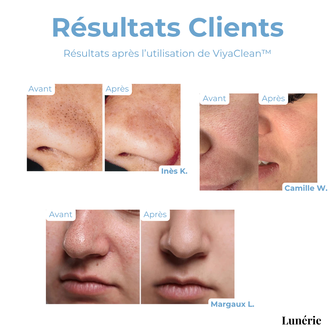 5+5 OFFERTS | ViyaClean™ Sérum Nettoyant pour les Pores